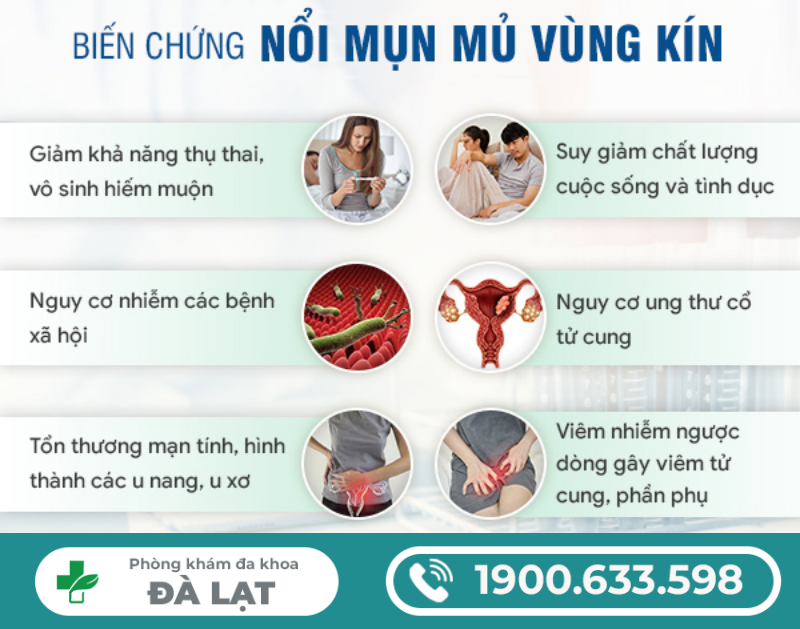 Hình ảnh minh họa